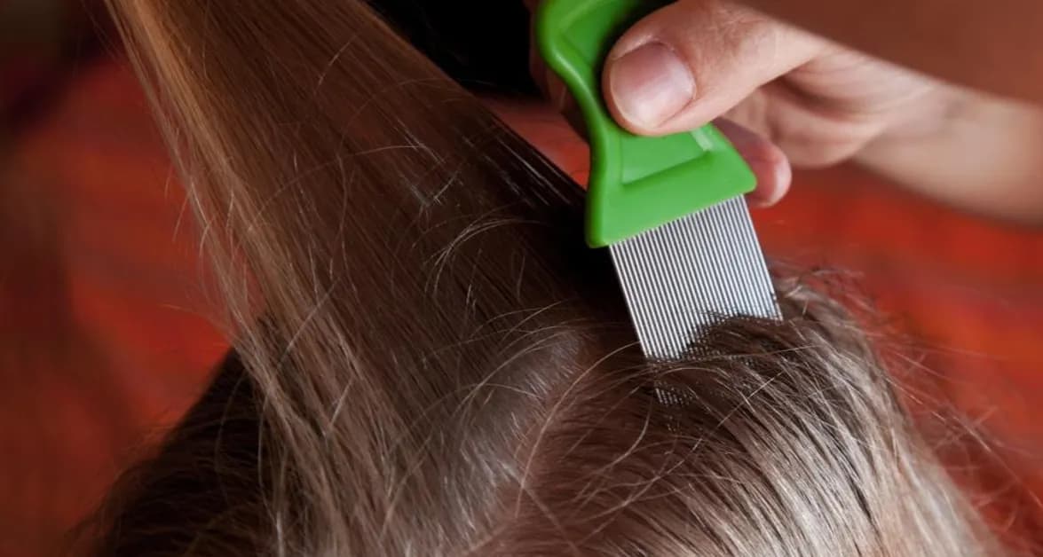 Jak walczyć z wszami u dziecka: skuteczne metody i porady na każdą sytuację Jak walczyć z wszami u dziecka: skuteczne metody i porady na każdą sytuację